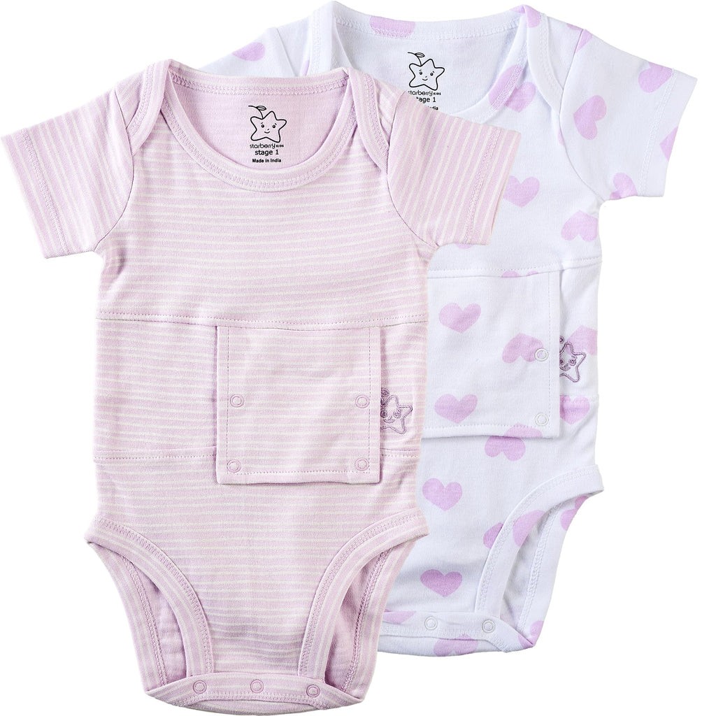 Adaptive G-Tube Baby Onesie